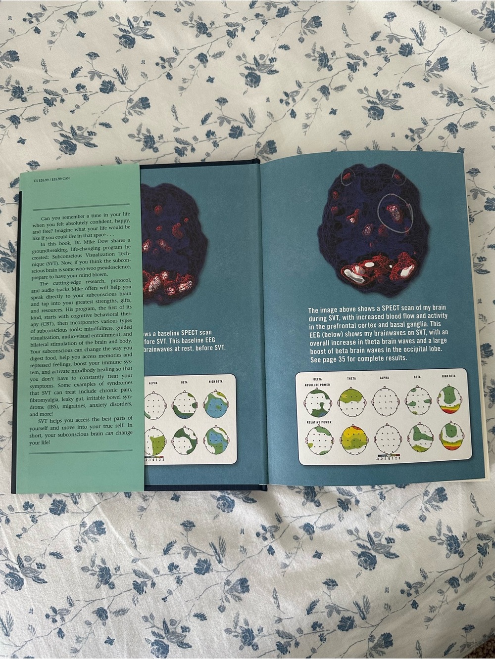 Your Subconscious Brain Can Change Your Life by Dr. Mike Dow (Hardcover) - Picture 2 of 5
